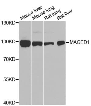 Polyclonal Rabbit anti-Human MAGED1 / NRAGE Antibody (IHC, IF, WB)
