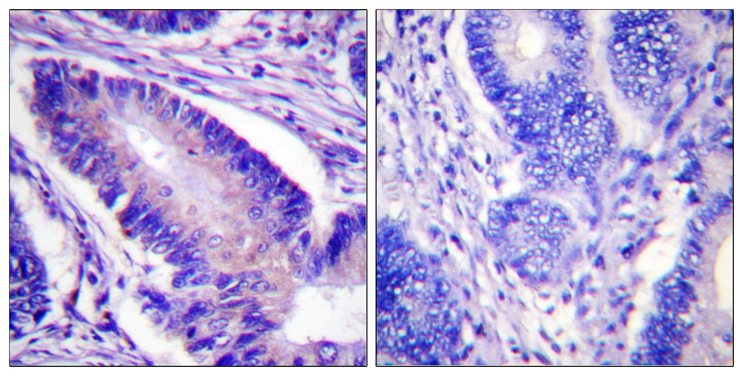 EIF4B Antibody (phospho-Ser422)