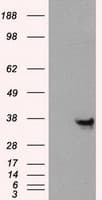 Monoclonal Mouse anti-Human ANXA10 / Annexin A10 Antibody (clone OTI4D8, IF, WB)