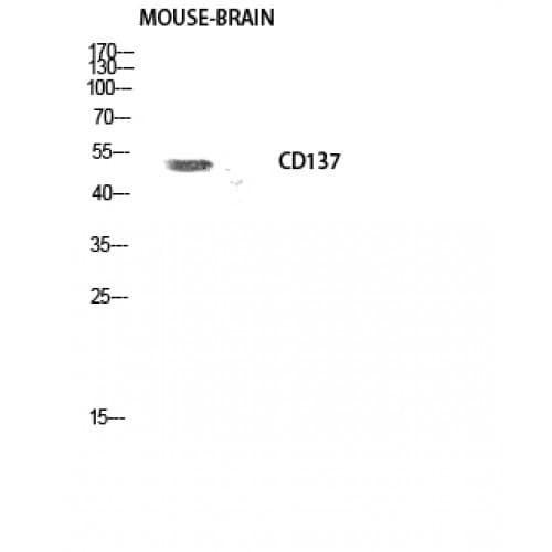 TNFRSF9 / 4-1BB / CD137 Antibody (70-150 aa, Internal)