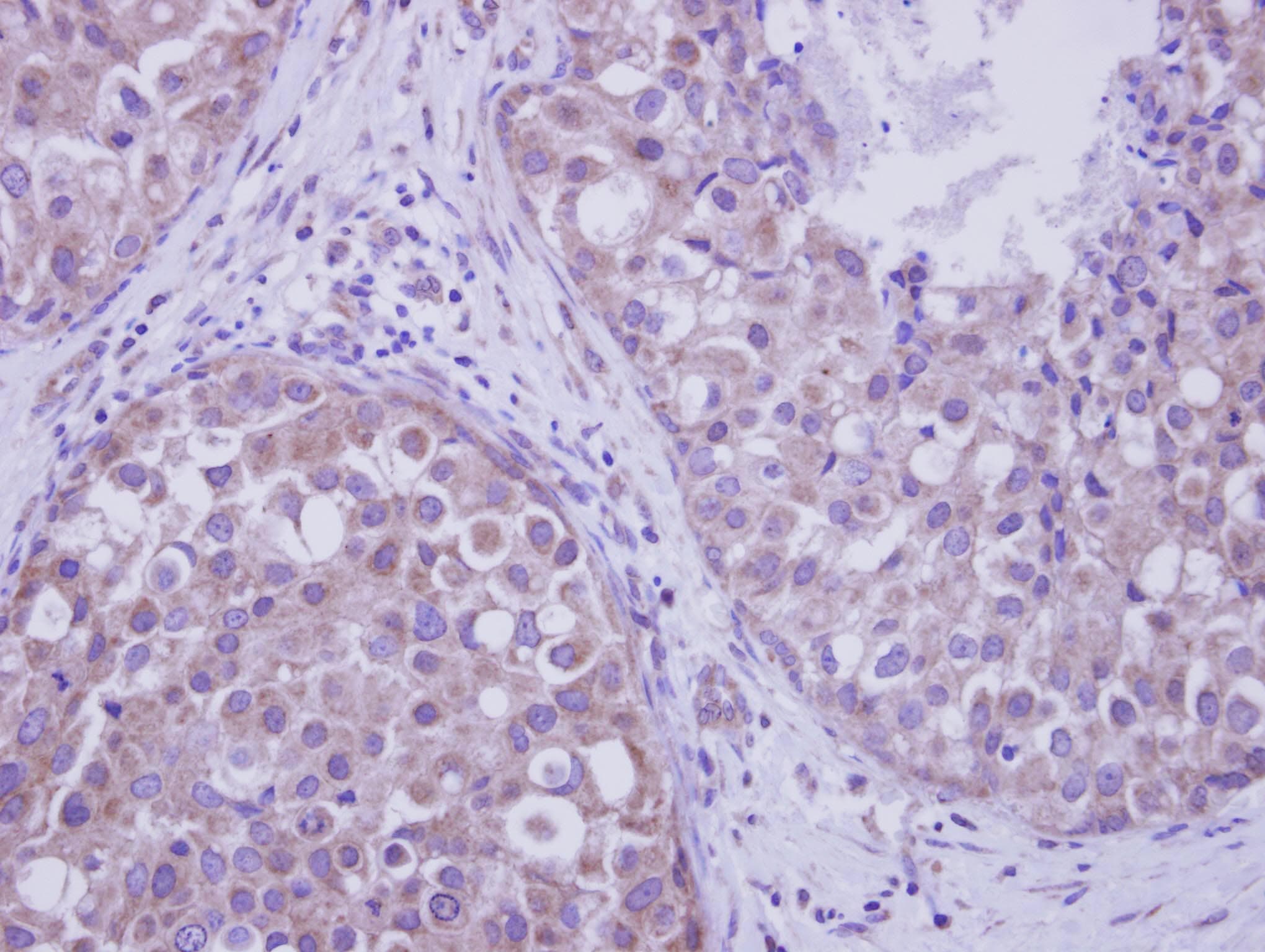 LIMK2 Antibody (aa1-252)