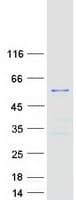 Human TTC19 Protein (Recombinant Myc-DDK (Flag))