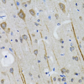 HTR3A / 5-HT3A Receptor Antibody