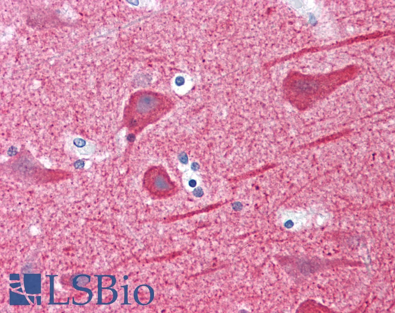 IHC-plus™ TUBB2B / Tubulin Beta 2B Antibody (clone AT5B3)