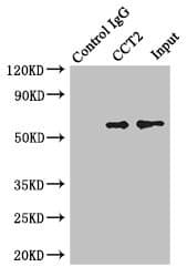 CCT2 / CCT Beta Antibody