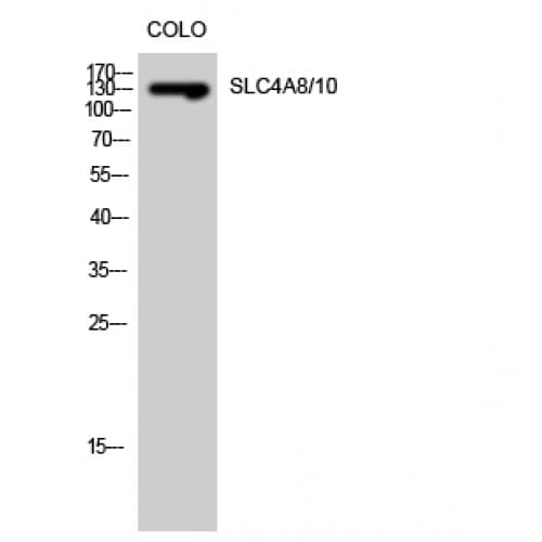 Polyclonal Rabbit anti-Human SLC4A8+10 Antibody (380-460 aa, Internal, IHC, WB)