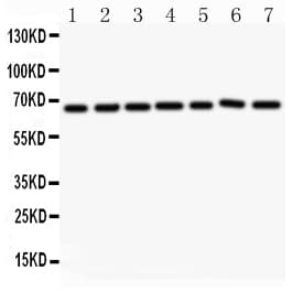 Polyclonal Rabbit anti-Human ANGPT1 / Angiopoietin-1 Antibody (aa16-350, WB)