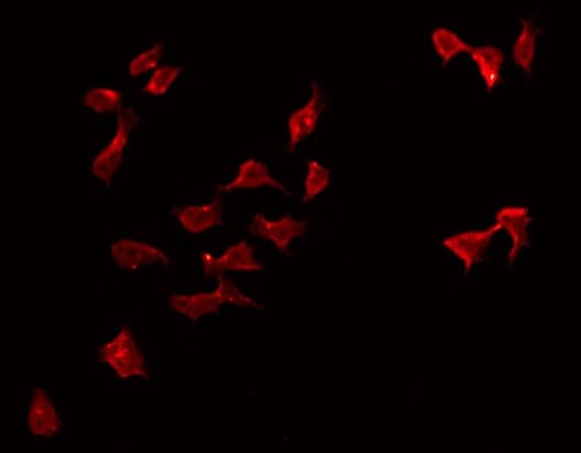 Carboxypeptidase A5 / CPA5 Antibody
