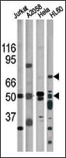 CHEK1 / CHK1 Antibody (phospho-Ser317)