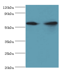 AHCYL1 / DCAL Antibody (aa31-260)