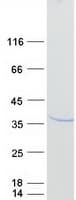 Human PPP1R1B / DARPP-32 Protein (Recombinant Myc-DDK (Flag))