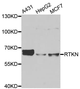 Polyclonal Rabbit anti-Human RTKN / Rhotekin Antibody (IHC, IF, WB)