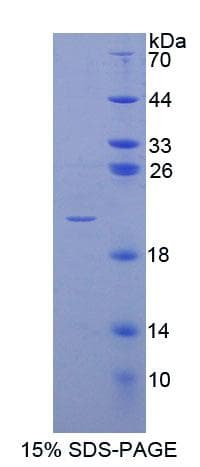 Human POFUT1 Protein (Recombinant His-T7)