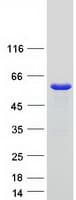 Human SNX17 Protein (Recombinant Myc-DDK (Flag))