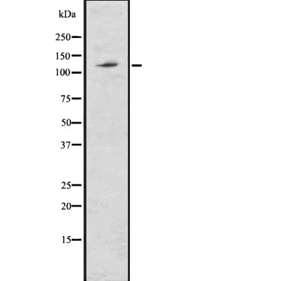 ABCG1 Antibody