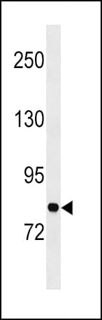IHC-plus™ GARS / Glycyl tRNA Synthetase Antibody (aa706-739)