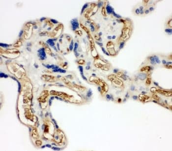 Polyclonal Rabbit anti-Human Adiponectin Antibody (aa224-244, IHC, WB)