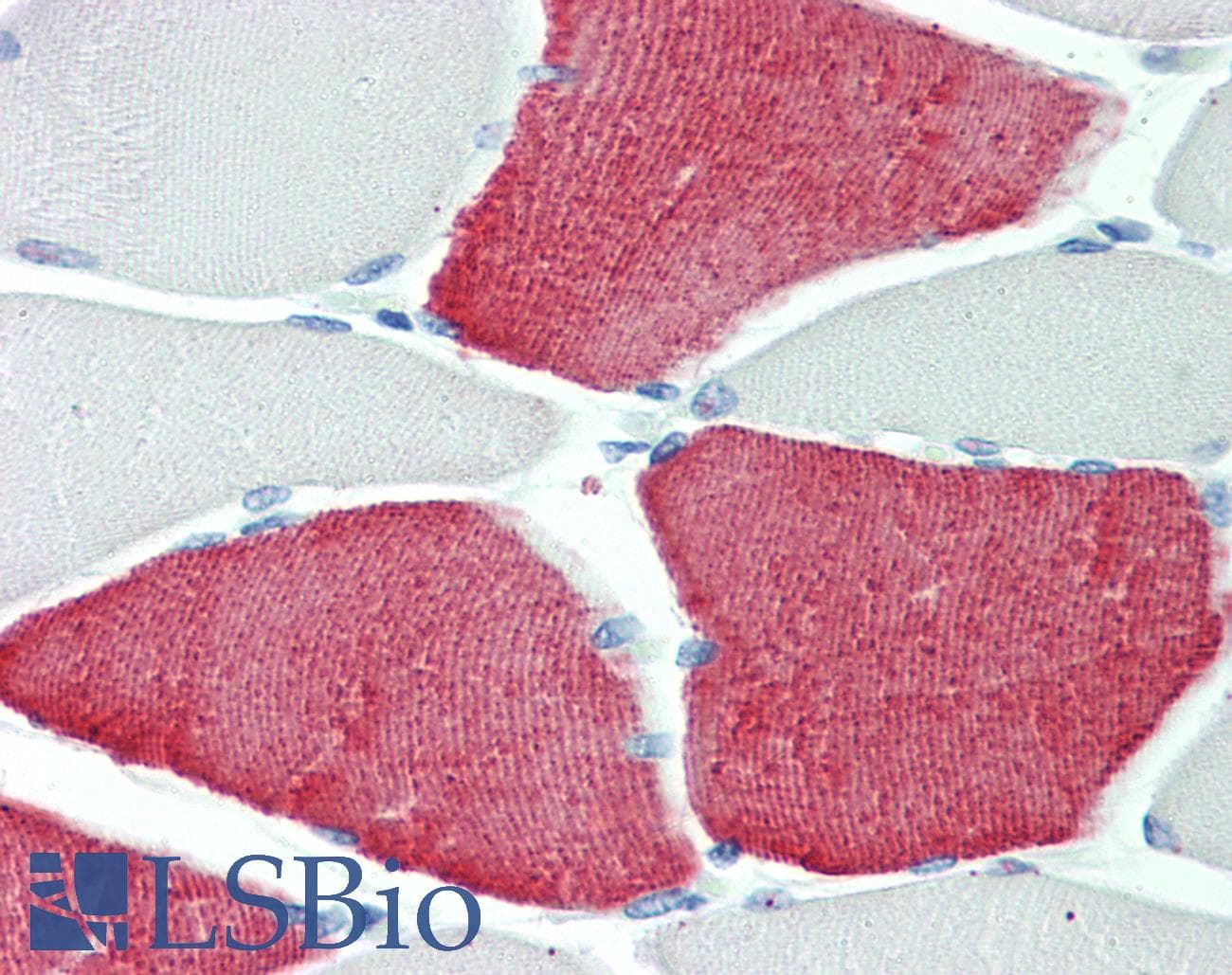 IHC-plus™ TNNT3 Antibody (aa232-246)