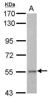 IHC-plus™ Polyclonal Rabbit anti-Human KRT71 / Keratin 71 Antibody (IHC, WB)