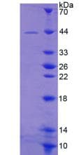 Mouse GRPR Protein (Recombinant His-GST)