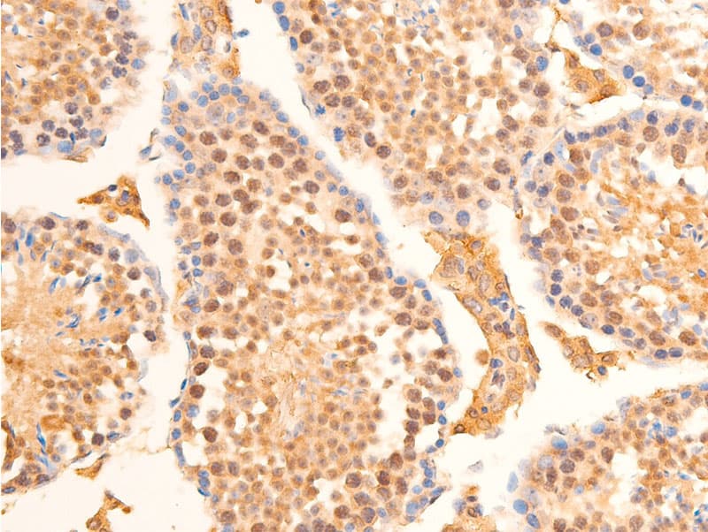 LMNA / Lamin A+C Antibody (phospho-Ser392)