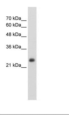 NNMT Antibody (N-Terminus)