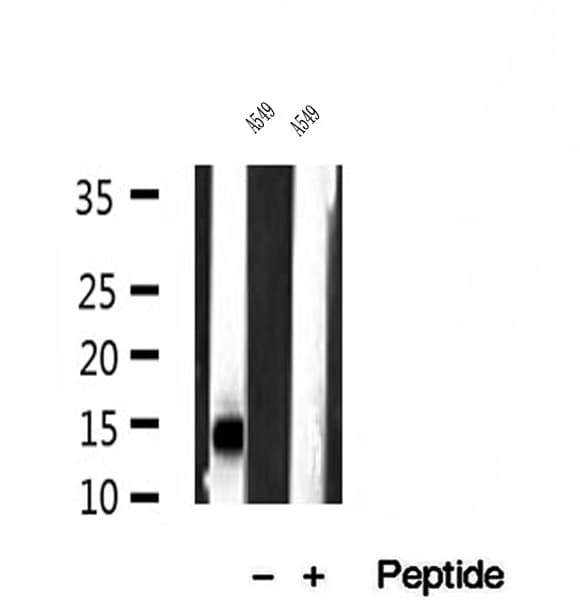 Polyclonal Rabbit anti-Human SRXN1 Antibody (IHC, WB)