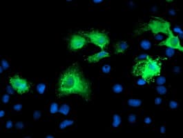 KATNB1 Antibody (clone OTI5A1)