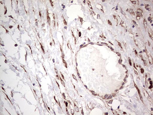LGALS3 / Galectin 3 Antibody (clone OTI2F1)