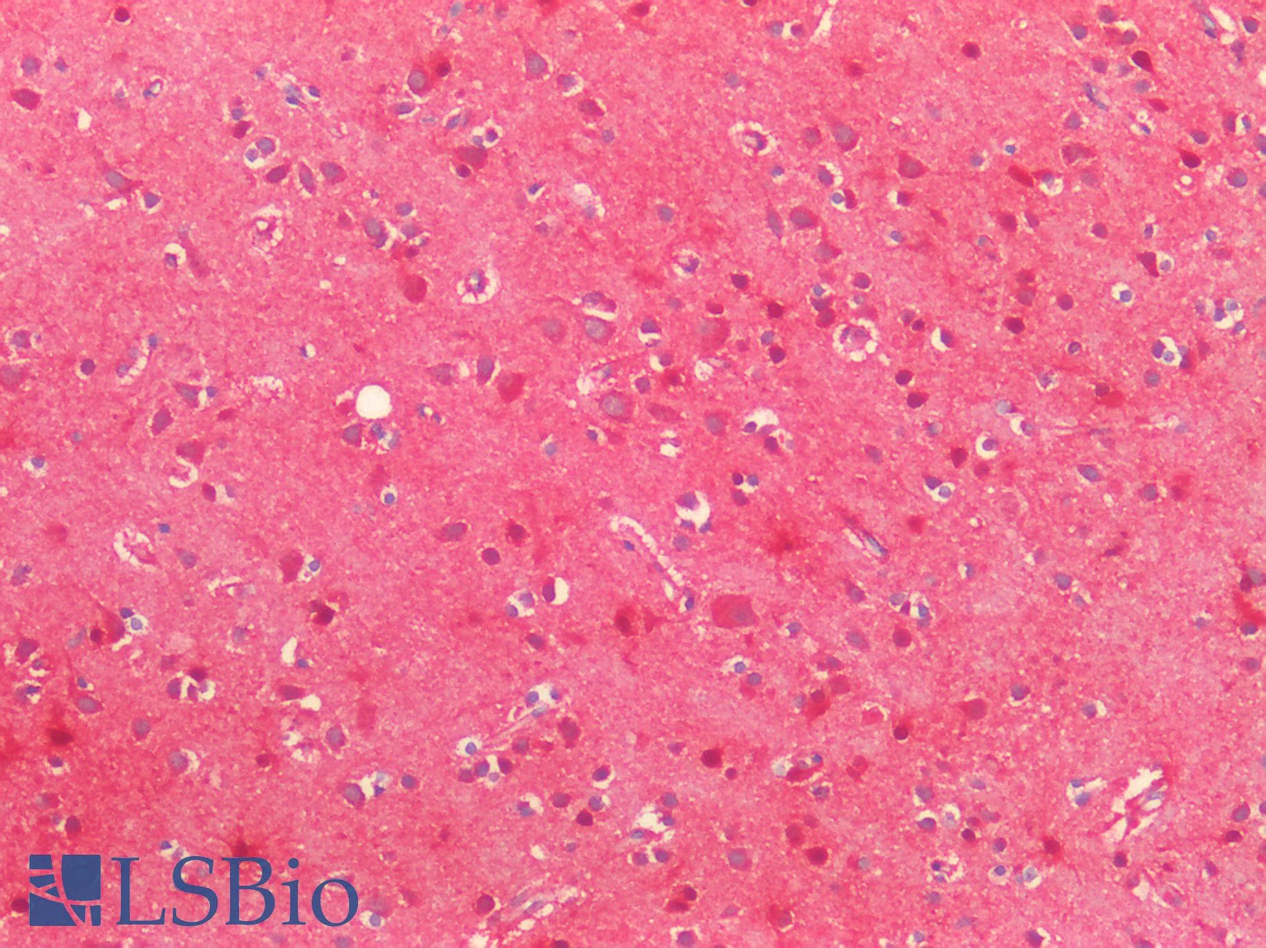 PathPlus™ SOD2 / Mn SOD Antibody (aa119-130)