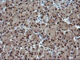 ESRRG / ERR Gamma Antibody (clone OTI6G1)
