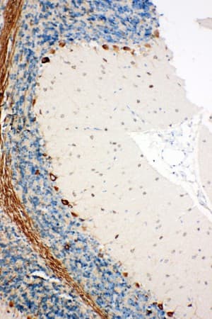 Polyclonal Rabbit anti-Human SSR3 / TRAP-Gamma Antibody (aa8-23, IHC, WB)