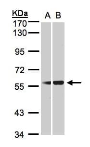 Polyclonal Rabbit anti-Human SERPING1 / C1 Inhibitor Antibody (aa77-420, IHC, WB)