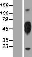 KIR2DL5A / KIR2DL5 Protein (Over-Expression Lysate Myc-DDK (Flag))
