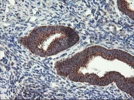 TRAP1 / HSP75 Antibody (clone OTI1A1)