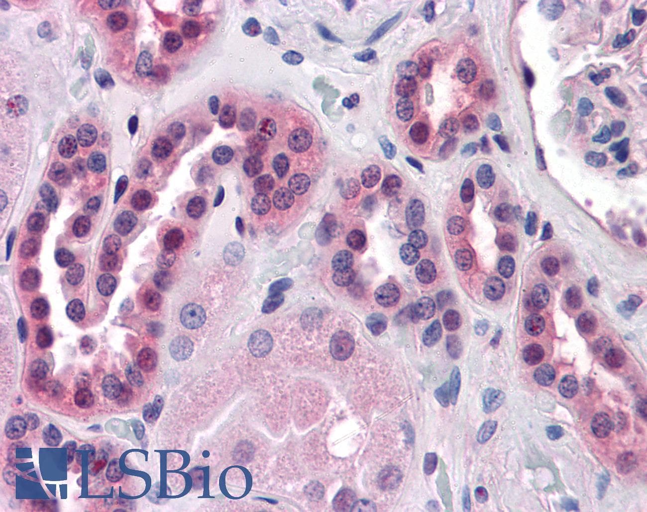 IHC-plus™ ERK1 + ERK2 Antibody (clone 3F8)