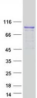 Human DHX15 Protein (Recombinant Myc-DDK (Flag))