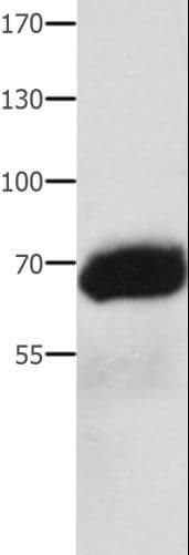 Polyclonal Rabbit anti-Human Alpha-Fetoprotein Antibody (IHC, WB)
