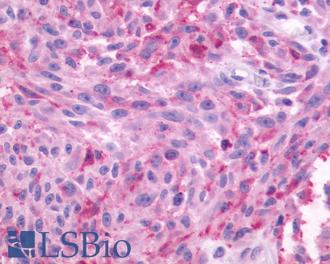 PathPlus™ NMBR Antibody (Cytoplasmic Domain)