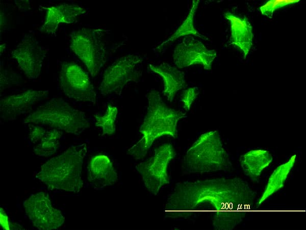 IHC-plus™ LDHB / Lactate Dehydrogenase B Antibody (clone 2H6)