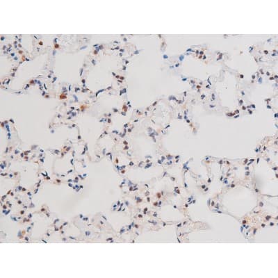 STAT3 Antibody (phospho-Ser727)