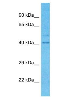 TRIM16L Antibody (aa11-60)