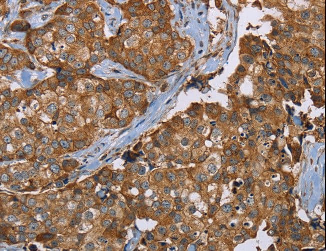 IHC-plus™ Polyclonal Rabbit anti-Human PLXNB1 / Plexin-B1 Antibody (IHC)