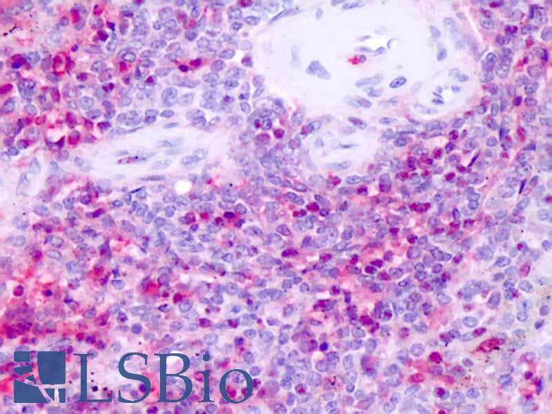 IHC-plus™ NR1D1 Antibody (Internal)