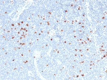 MKI67 / Ki67 Antibody (clone MKI67/2466)