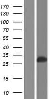 Human GSTM3 Protein (Over-Expression Lysate Myc-DDK (Flag))