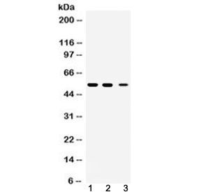 Polyclonal Rabbit anti-Human TUBB3 / Tubulin Beta 3 Antibody (IHC, WB)