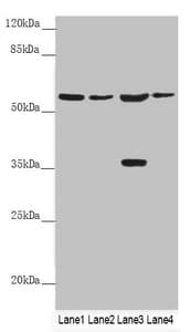SLC1A5 / ASCT2 Antibody