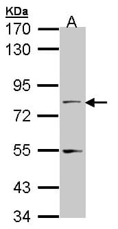 NXF1 / TAP Antibody (aa449-619)