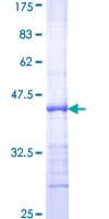 Human E2F2 Protein (Recombinant GST, N-terminus)